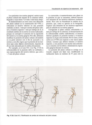 Visualización de objetivos de tratamiento 429
Los pacientes con sonrisa gingival, suelen tener
el plano oclusal más alejado de la comisura labial,
llegando a veces hasta 7 u 8 mm o más hacia abajo.
Si mantuviéramos en estos casos esta ubicación
del plano oclusal en la construcción del VTO, y
colocamos el incisivo inferior en una posición
estándar; es decir, 1mm por encima del plano oclu-
sal y el incisivo superior 1 mm por debajo de él, el
resultado estético de la sonrisa no será el adecuado,
porque no corregirá el aumento de la exposición
del incisivo y la sonrisa gingival. Por ello, debemos
modificar la posición del plano oclusal, elevándolo
en su parte anterior con el fin de acercarlo a la
norma y, con ello, lograr que la posición de los inci-
sivos (que como dijimos anteriormente, depende de
él) sea más adecuada para la estética del paciente.
Por ejemplo, en el caso N.C. (ver Fig. 17.33) la
sobremordida de la paciente debe ser atribuida a
una supraerupción del incisivo inferior, que está a
+ 5 mm del plano oclusal.
La corrección, si mantuviéramos este plano en
la posición en que se encuentra, debería hacerse
con intrusión de los incisivos inferiores exclusiva-
mente. Pero esto no beneficiará la estética de la
paciente, que, como se aprecia en la fotografía,
requiere una intrusión de los incisivos superiores
para la solución de su sonrisa gingival.
Corrigiendo el plano oclusal, colocándolo a 3
mm por debajo de la comisura, la interpretación de
la sobremordida cambia radicalmente; el incisivo
inferior quedaría en posición normal y el incisivo
superior es el que está extruido. Por lo tanto, al ubi-
carlos en el VTO con respecto a este nuevo plano
oclusal, veremos que deberá intruirse el incisivo
superior, y esta posición será mucho más armonio-
sa en relación con los labios y disminuirá la exposi-
ción gingival durante la sonrisa.
La posición del plano oclusal se corrige en el
trazado original con lápiz rojo, modificando su
inclinación hasta un máximo de 5°; para esto se
Fig. 17.33: Caso N.C. Planificación de cambio de inclinación del plano oclusal.
 