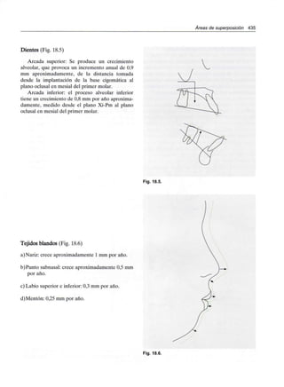 /Áreas de superposición 435
Dientes (Fig. 18.5)
Arcada superior: Se produce un crecimiento
alveolar, que provoca un incremento anual de 0,9
mm aproximadamente, de la distancia tomada
desde la implantación de la base cigomática al
plano oclusal en mesial del primer molar.
Arcada inferior: el proceso alveolar inferior
tiene un crecimiento de 0,8 mm por año aproxima-
damente, medido desde el plano Xi-Pm al plano
oclusal en mesial del primer molar.
Fig. 18.5.
Tejidos blandos (Fig. 18.6)
a)Nariz: crece aproximadamente 1 mm por año.
b)Punto subnasal: crece aproximadamente 0,5 mm
por año.
c) Labio superior e inferior: 0,3 mm por año.
d)Mentón: 0,25 mm por año.
Fig. 18.6.
 