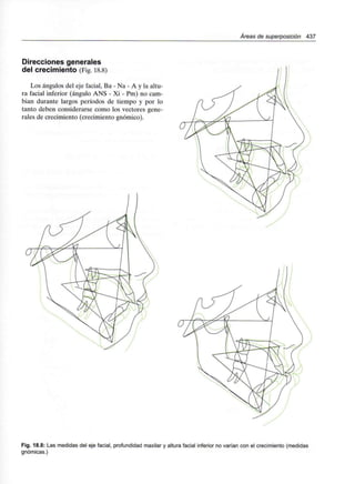 Áreas de superposición 437
Direcciones generales
del crecimiento (Fig. 18.8)
Los ángulos del eje facial, Ba - Na - A y la altu-
ra facial inferior (ángulo ANS - Xi - Pm) no cam-
bian durante largos períodos de tiempo y por lo
tanto deben considerarse como los vectores gene-
rales de crecimiento (crecimiento gnómico).
Fig. 18.8: Las medidas del eje facial, profundidad maxilar y altura facial inferior no varían con el crecimiento(medidas
gnómicas.)
 