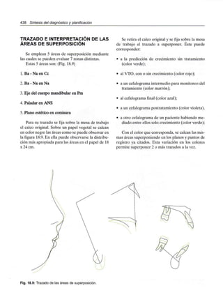 438 Síntesis del diagnóstico y planificación
TRAZADO E INTERPRETACIÓN DE LAS
ÁREAS DE SUPERPOSICIÓN
Se emplean 5 áreas de superposición mediante
las cuales se pueden evaluar 7 zonas distintas.
Estas 5 áreas son: (Fig. 18.9)
l.Ba-NaenCc
2. Ba - Na en Na
3. Eje del cuerpo mandibular en Pm
4. Paladar en ANS
5. Plano estético en comisura
Para su trazado se fija sobre la mesa de trabajo
el calco original. Sobre un papel vegetal se calcan
en color negro las áreas como se puede observar en
la figura 18.9. En ella puede observarse la distribu-
ción más apropiada para las áreas en el papel de 18
x 24 cm.
Se retira el calco original y se fija sobre la mesa
de trabajo el trazado a superponer. Éste puede
corresponder:
• a la predicción de crecimiento sin tratamiento
(color verde);
• al VTO, con o sin crecimiento (color rojo);
• a un cefalograma intermedio para monitoreo del
tratamiento (color marrón);
• al cefalograma final (color azul);
• a un cefalograma postratamiento (color violeta).
• a otro cefalograma de un paciente habiendo me-
diado entre ellos solo crecimiento (color verde);
Con el color que corresponda, se calcan las mis-
mas áreas superponiendo en los planos y puntos de
registro ya citados. Esta variación en los colores
permite superponer 2 o más trazados a la vez.
Fig. 18.9: Trazado de las áreas de superposición.
 