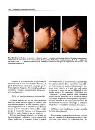 462 Tratamiento ortodóncico-quirúrgico
Fig. 19.2: El paciente debe conocer las verdaderas causas y consecuencias de su problemas. En este proceso se utili-
zarán recursos como la medición y comparación de los perfiles. A: Perfil con medidas ideales. B: Perfil y medidas del
paciente a tratar. C: El resultado obtenido con el tratamiento ortodóncico-quirúrgico de la paciente B son similares a las
ideales de la paciente A.
En cuanto al post-operatorio, si el paciente se
encuentra con lo que efectivamente buscaba, el
grado de aceptación será mayor. La cirugía queda-
rá inscripta en el registro del deseo planteado por
el paciente y no como una imposición del ortodon-
cista o del cirujano.
2) No hay una demanda explícita de cambio.
En otros pacientes no hay un cuestionamiento
estético, o no hay un deseo expreso de cambio o bien
este cambio es resistido. Recién comienzan a adver-
tir ciertos problemas en su cara a través del discurso
médico y de los parámetros estéticos. Ello sucede
porque la percepción, tramada en el lenguaje, nos
permite ver según el discurso que nos atraviesa.
Éste es generalmente el motivo por el cual no
hay una demanda explícita de cambio, es más bien
difusa, justificando la necesidad de una cirugía el
aspecto funcional, el mejoramiento de la calidad de
vida, de lo necesario desde el punto de vista médi-
co. Es decir que este argumento hace marco y fun-
ciona como paliativo a lo que para cada sujeto
representa el punto de mayor dificultad: donde
pueda aparecer lo traumático. Entiéndase por
"traumático", término muchas veces connotado
negativamente, una irrupción de estímulos para la
cual el aparato psíquico no está preparado para asi-
milarlos. Se trata de un exceso que sorprende. El
entender que es necesaria una cirugía es un hecho
traumático y requerirá un tiempo de elaboración.
3) Quiero seguir siendo como soy, pero acato la
decisión del profesional.
Esta posición muestra claramente que estamos
ante una gran dificultad. El sujeto no se implica y se
posiciona como objeto de experimentación. Se
 