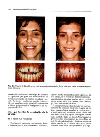 464 Tratamiento ortodóncico-quirúrgico
Fig. 19.3: Paciente de Clase
tencia del mismo.
con un importante diastema interincisivo. En las fotografías finales se observa la persis-
to esperable de resistencia a la cirugía. Es necesaria
la explicación por parte del profesional de los
métodos actuales de osteosíntesis con placas y tor-
nillos de titanio, y también de material reabsorbi-
ble, con todas las ventajas que significan en cuanto
a confort posquirúrgico al no requerir de un blo-
queo intermaxilar.
Vías que facilitan la aceptación de la
cirugía.
1). El énfasis en lo reparatorio.
En el decir de algunos de estos pacientes donde
el deseo de cambio se combina con la resistencia,
aparece mucho más el énfasis en lo reparatorio de
esta cirugía, en la posibilidad de recuperar funcio-
nes fisiológicas alteradas: masticar mejor, respirar
mejor, deglutir mejor, etc. Es decir, tratar esta ciru-
gía como una cuestión de salud.
Consideramos que ésta es la mejor vía para fun-
damentar la necesidad de cirugía. A pesar de no
tener caras armónicas, a muchos de estos pacientes,
el Otro les ofreció una buena mirada y si no hay
una buena razón, hay algo de sacrilego en tocar lo
que a uno le fue dado: sea Dios, la Naturaleza o los
propios padres. Convengamos que se modifica un
real. No sólo es lo fisiológicoy funcional una buena
razón, más allá de lo estético, que a veces puede
objetarse como banal, sino que también este argu-
 