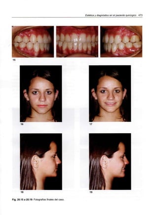 Estética y diagnóstico en el paciente quirúrgico 473
Fig. 20.15 a 20.19: Fotografías finales del caso.
 