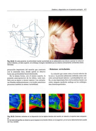 Estética y diagnóstico en el paciente quirúrgico 477
Fig. 20.22: En esta paciente, la profundidad maxilar aumentada de la cefalometría nos induce a pensar en retruir el
punto A blando y el labio superior, sin embargo el ángulo nasolabial que se observa clínicamente contraindica dicho
retroceso.
proyección importante del mentón que contrasta
con la anatomía ósea, donde quizás se observe
hasta una profundidad facial disminuida.
De la misma forma, con el mismo soporte, la
posición anteroposterior de los labios, varía tam-
bién con su mayor o menor espesor. Las estructu-
ras blandas submentonianas y cervicales anteriores
presentan también la misma variabilidad.
- Relaciones cervicofaciales.
La relación que existe entre el tercio inferior de
la cara y la porción submental, definida como rela-
ción cervical-facial inferior o profundidad de cue-
llo, es una importante llave de la estética facial y no
existe ninguna medición análoga en los cefalogra-
mas dentoesqueletales.
Fig. 20.23: Distintas variantes en la disposición de los tejidos blandos del mentón en relación al soporte óseo subyacen-
te.
En las telerradiografías se observa que el espesor en el borde inferior, en el pogonion y en el surco labiomentoniano puede
ser muy variable.
 
