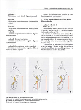 Estética y diagnóstico en el paciente quirúrgico 483
Medida A
Distancia del punto glabela al punto subnasal.
Medida B
Distancia del punto subnasal al punto mentón
cutáneo.
Medida C
Distancia del punto subnasal al punto stomion
superior.
Medida D
Distancia del punto stomion inferior al punto
mentón cutáneo.
Medida E (Espacio interlabial)
Distancia del punto stomion superior al punto
stomion inferior
Medida F (Exposición del incisivo superior)
Distancia del punto stomion superior al borde
incisal del incisivo superior.
Una vez determinadas estas medidas, se estu-
dian las siguientes proporciones:
1. Altura del tercio medio de la cara / Altura
del tercio inferior
Medida A / Medida B
Norma A = B
En caucásicos, el valor medio de esta relación,
en una cara armónica, es de 1 : 1, aceptándose des-
viaciones del orden del 5%.
El aumento de la altura del tercio inferior de la
cara es frecuente en los casos de exceso vertical del
maxilar, en los de exceso vertical del mentón, en la
mayoría de las Clases III con aumento de la dimen-
sión vertical, y en las mordidas abiertas esqueleta-
les (Fig. 20.28).
La disminución de la altura del tercio inferior de
la cara, se asocia a déficit vertical del maxilar, a
retrusión mandibular con mordida profunda y a
déficit vertical del mentón (Fig. 20.29).
B
Fig. 20.28: Aumento del tercio inferior de la cara.
A: Aumento del espacio interlabial por exceso vertical del maxilar superior.
B: Aumento del tercio inferior por exceso vertical del mentón.
C: Aumento del espacio interlabial por mordida abierta.
 