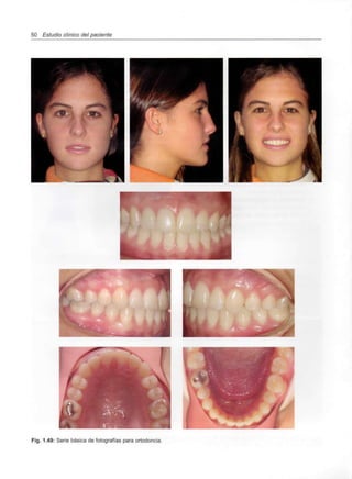 50 Estudio clínico del paciente
Fig. 1.49: Serie básica de fotografías para ortodoncia.
 