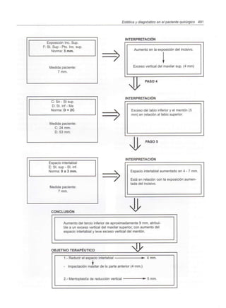 Estética y diagnóstico en el paciente quirúrgico 491
Exposición Inc. Sup.
F: St. Sup - Pto. Inc. sup.
Norma: 3 mm.
Medida paciente:
7 mm.
7>
INTERPRETACIÓN
Aumento en la exposición del incisivo.
Exceso vertical del maxilar sup. (4 mm)
4 PASO 4
C: Sn - St sup.
D:St. inf- Me
Norma: D = 2C
Medida paciente:
C: 24 mm.
D: 53 mm.
INTERPRETACIÓN
Exceso del labio inferior y el mentón (5
mm) en relación al labio superior.
PASOS
Espacio interlabial
E: St. sup - St. inf.
Norma: Oa 3 mm.
Medida paciente:
7 mm.
CONCLUSIÓN
INTERPRETACIÓN
Espacio interlabial aumentado en 4 - 7 mm.
Está en relación con la exposición aumen-
tada del incisivo.
Aumento del tercio inferior de aproximadamente 9 mm, atribui-
ble a un exceso vertical del maxilar superior, con aumento del
espacio interlabial y leve exceso vertical del mentón.
OBJETIVO TERAPÉUTICO
1.- Reducir el espacio interlabial »
- Impactación maxilar de la parte anterior (4 mm.)
4 mm.
2.- Mentoplastía de reducción vertical 5 mm.
 