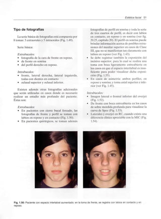 Estética facial 51
Tipo de fotografías
La serie básica de fotografías está compuesta por
8 tomas: 3 extraorales y 5 intraorales (Fig. 1.49).
Serie básica:
Extrabucales:
• fotografía de la cara de frente en reposo,
• de frente en sonrisa
• del perfil derecho en reposo.
Intrabucales:
• frente, lateral derecha, lateral izquierda,
todas con dientes en contacto
• oclusal superior y oclusal inferior.
Existen además otras fotografías adicionales
que serán utilizadas en casos donde es necesario
realizar un estudio más profundo del paciente.
Éstas son:
Extrabucales:
• En pacientes con cierre bucal forzado, las
fotografías de frente y perfil se toman con
labios en reposo y en contacto (Fig. 1.50).
• En pacientes quirúrgicos, se toman además
fotografías de perfil en sonrisa y toda la serie
de tres cuartos de perfil, es decir con labios
en contacto, en reposo y en sonrisa (ver fig.
20.25, capítulo 20). El perfil en sonrisa puede
brindar información acerca de posibles retru-
siones del maxilar superior en casos de Clase
III, que no se manifiestan tan claramente con
labios en reposo (ver Fig. 1.43).
• Se debe registrar también la exposición del
incisivo superior, para lo cual se realiza una
toma con boca ligeramente entreabierta en
los casos en que el espacio interlabial es insu-
ficiente para poder visualizar dicha exposi-
ción (Fig. 1.55).
• En casos de asimetría: ambos perfiles, en
reposo y sonrisa; y toma axial superior e infe-
rior (ver Fig. 1.45).
Intrabucales:
• Imagen lateral o frontal inferior del overjet
(Fig. 1.52).
• De frente con boca entreabierta en los casos
de sobre mordida profunda para visualizarla
curva de Spee (Fig. 1.53).
• Laterales y overjet en RC, cuando exista una
diferencia clínica apreciable con la MIC (Fig.
1.54).
Fig. 1.50: Paciente con espacio interlabial aumentado: en la toma de frente, se registra con labios en contacto y en
reposo.
 