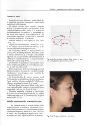Estética y diagnóstico en el paciente quirúrgico 503
Evaluación Nasal
La predicción nasal deberá ser hecha al final de
la predicción quirúrgica,después de establecida la
posición del labio superior.
El nasion cutáneo (Nc), también llamado
Sellion, es el punto cutáneo más profundo de la
curvatura nasofrontal Este punto es el vértice del
ángulo nasofrontal, formado por la intersección de
dos líneas: una tangente a la glabela (Gl-Nc), la
otra tangente a pronasal (Pn-Nc), que en presencia
de un dorso prominente lo intersecta.
El valor normal de este ángulo, se sitúa entre
120° y 135°.
La posición anteroposterior y vertical del vérti-
ce del ángulo nasofrontal (nasion cutáneo) es de
extrema importancia en la planificación.
En condiciones ideales, el nasion cutáneo se
localiza cerca de 6 mm por encima del cantus, entre
el pliegue supratarsal y el margen del párpado
superior, con los ojos abiertos, aproximadamente 9
a 13 mm en posición anterior a la proyección de la
córnea (R. Daniel) (Fig. 20.58).
La distancia, proyectada en la horizontal, entre
nasion cutáneo y la glabela, es en condiciones idea-
les, de 4 a 6 mm (Guyuron).
El reconocimiento de la importancia posicional
del nasion cutáneo altera no sólo los objetivos de la
planificación prequirúrgica, sino también la
secuencia operatoria.
La determinación del nasion cutáneo ideal
(Nci), permite la definición del ángulo naso-facial,
el cual establece la línea dorsal ideal (Pn-Nc) y con-
tribuye a la nueva proyección de la punta.
La línea dorsal ideal, es rectilínea en los hom-
bres, pudiendo en las mujeres presentar una ligera
concavidad, 1 a 2 mm por detrás de ésta.
El ángulo nasofacial resulta de la intersección
de la línea dorsal con la perpendicular del nasion
cutáneo: su valor es de 34° para mujeres y 36° para
hombres (Fig. 20.59).
Métodos complementarios de evaluaciónnasal:
En los casos donde se indican cambios en la
proyección nasal, se considera conveniente corro-
borarlos mediante métodos que evalúan la propor-
ción entre la longitud y la base de la nariz (métodos
de Baum y de Goode) y entre la proyección nasal y
la longitud del labio superior (método de Simons).
Fig. 20.58: Punto nasion cutáneo. Se lo analiza en rela-
ción a los párpados,globo ocular y glabela.
Fig. 20.59: Ángulo nasofrontaly nasofacial.
 