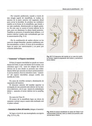 Bases para la planificación 511
- Por rotación antihoraria, cuando a través de
una cirugía sagital de mandíbula, se realiza un
ascenso de la parte anterior del segmento distal
para cerrar la mordida. Se produce un verdadero
cambio en la forma de la mandíbula, que tiende a
ser más cuadrada, disminuyendo su ángulo gonía-
co. En este caso se acorta el tercio inferior de la
cara, pero no disminuye la altura facial posterior.
También se proyecta el mentón hacia delante, y el
incisivo inferior resulta más verticalizado que con
la autorrotación (Fig. 21.6)
- Por la combinación de ambos efectos: en los
casos de cirugía bimaxilar, pueden combinarse am-
bos mecanismos, es decir, el cierre de la mordida se
logra en parte por autorrotación y en parte por
rotación antihoraria.
- "Aumentar" el Espaciointerlabial:
Si bien el espacio interlabial no puede ser nunca
menos de O mm, lo que está dentro de la norma, nos
referimos aquí a los casos de colapso del tercio
inferior de la cara donde se presenta una redun-
dancia labial que necesita un mejor posicionamien-
to de los mismos. Esto lo referimos como "aumen-
to" del espacio interlabial, aunque resulte una
medida de O mm.
En casos de overbite normal y disminución de
exposición del incisivo:
El descenso anterior del maxilar superior se
acompaña de una posición más inferior de los inci-
sivos inferiores, con lo que mejora la redundancia
labial y aumenta el tercio inferior de la cara(Fig.
21.7).
En casos de Clase II:
El avance de la mandíbula logra un efecto de
aumento vertical, mayor cuanto más inclinado esté
el plano oclusal.
Fig. 21.7: El descensodel maxilar en un caso de overbi-
te normal, mejora la exposicióndel incisivo y aumenta el
tercio inferior.
- Aumentar la alturadel mentón (alargar el mentón):
Se logra a través de una mentoplastia con injerto
(Fig. 21.9 A y B).
Fig. 21.8: El avance mandibular en casos de Clase II con
sobremordida profunda,tiene un efecto de aumentoverti-
cal del tercioinferior.
 