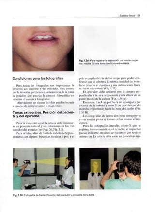 Estética facial 53
Fig. 1.55: Para registrar la exposicióndel insicivo supe-
rior, resulta útil una toma con boca entreabierta.
Condiciones para las fotografías
Para todas las fotografías son importantes la
posición del paciente y del operador, este último
por la relación que tiene en la incidencia de la toma
la posición que guarda la cámara fotográfica en
relación al campo a fotografiar.
Alteraciones en alguna de ellas pueden inducir
a errores de interpretación y diagnóstico.
Tomas extraorales. Posición del pacien-
te y del operador.
Para la toma extraoral, la cabeza debe orientar-
se en posición natural y sin rotaciones en los tres
sentidos del espacio (ver Pag. 20, Fig. 1.3).
Para la fotografías de frente la cabeza debe posi-
cionarse con el plano bipupilar paralelo al piso y el
pelo recogido detrás de las orejas para poder con-
firmar que se observa la misma cantidad de hemi-
facie derecha e izquierda y sin inclinaciones hacia
arriba o hacia abajo (Fig. 1.57).
El operador debe ubicarse con la cámara per-
pendicular a la cara del paciente y a la altura de un
punto medio de la cabeza (Fig. 1.56 A).
Encuadre: 2 o 3 cm por fuera de las orejas y por
encima de la cabeza y unos 5 cm por debajo del
mentón, registrando hasta la base del cuello (Fig.
1.56 B).
Las fotografías de frente con boca entreabierta
y con sonrisa plena se toman en las mismas condi-
ciones.
Para las fotografías laterales, el perfil que se
registra habitualmente es el derecho, el izquierdo
puede utilizarse en casos de pacientes con severas
asimetrías. La cabeza debe estar en posición relaja-
Fig. 1.56: Fotografíade frente: Posición del operador y encuadre de la toma.
 