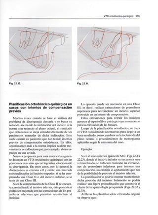 VTO ortodóncico-quirúrgico 535
Fig. 22.30. Fig. 22.31.
Planificación ortodóncico-quirúrgica en
casos con intentos de compensación
previos
Muchas veces, cuando se hace el análisis del
problema de discrepancia dentaria y se busca su
solución acercando la inclinación del incisivo a la
norma con respecto al plano oclusal, el resultado
que obtenemos se aleja considerablemente de los
parámetros normales de dicha inclinación. Esto
suele ocurrir en pacientes que han tenido intentos
previos de compensación ortodóncica. En ellos,
aproximarnos más a la norma implica realizar mo-
vimientos ortodóncicos que, por ejemplo, abran es-
pacios en una arcada.
Nuestra propuesta para esos casos es la siguien-
te: Intentar un VTO ortodóncico-quirúrgico con las
posiciones dentarias que se lograrían solucionando
la discrepancia. En estos casos, por lo general la
discrepancia es cercana a O y existe una marcada
retroinclinación del incisivo superior, si se ha com-
pensado una Clase II o del incisivo inferior, .si se
trata de una Clase III.
Si en la compensación de la Clase II se encuen-
tra proinclinado el incisivo inferior, esta posición sí
podrá ser mejorada con las extracciones de los pre-
molares inferiores que permitan retroinclinar el
incisivo.
Lo opuesto puede ser necesario en una Clase
III, es decir, realizar extracciones de premolares
superiores para retroinclinar un incisivo superior
protruido en un intento de compensación.
Estas extracciones para retruir los incisivos
generan el espacio libre quirúrgico que es necesario
para la corrección de las básales.
Luego de la planificación ortodóncica, se traza
el VTO considerando alternativas para llegar a un
buen resultado, como: cambios en la inclinación del
plano oclusal o procedimientos de mentoplastia
aplicables según la anatomía del caso.
Ejemplo:
Si en el caso anterior (paciente M.C. Figs 22.4 a
22.23), donde el incisivo inferior se encuentra muy
retroinclinado, se hubiesen realizado las extraccio-
nes de premolares inferiores para intentar una
compensación, no existiría el apiñamiento que nos
da la posibilidad de protruir el incisivo inferior.
La planificación se podría intentar manteniendo
dicha posición del incisivo. Solamente se podría
realizar una ligera proinclinación que generaría el
efecto de la aparatología preajustada (Figs. 22.32 y
22.33).
Al llevar las plantillas sobre el trazado original
se observa que:
 