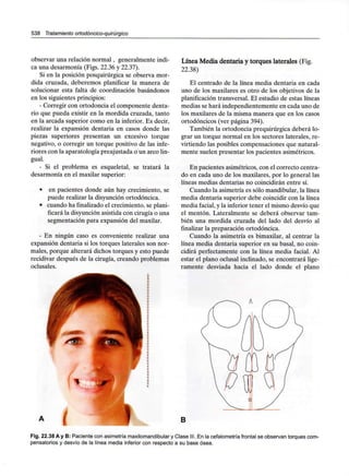 538 Tratamiento ortodóndco-quirúrgico
observar una relación normal, generalmente indi-
ca una desarmonía (Figs. 22.36 y 22.37).
Si en la posición posquirúrgica se observamor-
dida cruzada, deberemos planificar la manera de
solucionar esta falta de coordinación basándonos
en los siguientes principios:
- Corregir con ortodoncia el componente denta-
rio que pueda existir en la mordida cruzada, tanto
en la arcada superior como en la inferior. Es decir,
realizar la expansión dentaria en casos donde las
piezas superiores presentan un excesivo torque
negativo, o corregir un torque positivo de las infe-
riores con la aparatología preajustada o un arcolin-
gual.
- Si el problema es esqueletal, se tratará la
desarmonía en el maxilar superior:
- en pacientes donde aún hay crecimiento, se
puede realizar la disyunción ortodóncica.
- cuando ha finalizado el crecimiento, se plani-
ficará la disyunción asistida con cirugía o una
segmentación para expansión del maxilar.
- En ningún caso es conveniente realizar una
expansión dentaria si los torques laterales sonnor-
males, porque alterará dichos torques y esto puede
recidivar después de la cirugía, creando problemas
oclusales.
Línea Media dentaria y torques laterales (Fig.
22.38)
El centrado de la línea media dentaria en cada
uno de los maxilares es otro de los objetivos de la
planificación transversal. El estudio de estas líneas
medias se hará independientemente en cada uno de
los maxilares de la misma manera que en los casos
ortodóncicos (verpágina394).
También la ortodoncia prequirúrgica deberá lo-
grar un torque normal en los sectores laterales, re-
virtiendo las posibles compensaciones que natural-
mente suelen presentar los pacientes asimétricos.
En pacientes asimétricos, con el correcto centra-
do en cada uno de los maxilares, por lo general las
líneas medias dentarias no coincidirán entre sí.
Cuando la asimetría es sólo mandibular, la línea
media dentaria superior debe coincidir con la línea
media facial, y la inferior tener el mismo desvío que
el mentón. Lateralmente se deberá observar tam-
bién una mordida cruzada del lado del desvío al
finalizar la preparación ortodóncica.
Cuando la asimetría es bimaxilar, al centrar la
línea media dentaria superior en su basal, no coin-
cidirá perfectamente con la línea media facial. Al
estar el plano oclusal inclinado, se encontrará lige-
ramente desviada hacia el lado donde el plano
B
Fig. 22.38 A y B: Paciente con asimetría maxilomandibulary Clase III. En la cefalometría frontal se observan torquescom-
pensatorios y desvío de la línea media inferior con respecto a su base ósea.
 