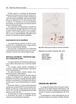 546 Tratamiento ortdóncico-quirúrgico
El labio superior se mantiene sin alteraciones,
así como las estructuras que están por encima de él.
El surco labial y el mentón cutáneo traducirán el
100% del avance mandibular,mientras que el labio
inferior se adelantará el 75 % del avance del incisi-
vo inferior. La asociación de los dos movimientos
determinará, en consecuencia, una mayor abertura
del surco labiomentoniano.
Por el contrario, las alteraciones verticales son
muy variables. Es de gran importancia en los casos
de mala relación del labio inferior con el incisivo
superior o con el labio superior, que la planifica-
ción se base en telerradiografías obtenidas con el
paciente en posición de reposo mandibular.
Autorrotación de la mandíbula
Los tejidos blandos traducen al 100% la auto-
rrotación de la mandíbula, pero el labio inferior
revela un comportamiento distinto.
Por una parte, la disminución de la dimensión
vertical lo hace de mayor espesor, por otra, la auto-
rrotación le permite una discreta linguoversión.
Retroceso mandibular - Osteotomía sagi-
tal o vertical de la rama
La región subnasal y las estructurassuprayacen-
tes no sufren alteraciones con el retroceso mandi-
bular.
Los restantes tejidos blandos acompañan el
retroceso, sufriendo desplazamientos porcentual-
mente más importantes.
En orden decreciente, mentón cutáneo, surco
labio mentoniano y labio inferior.
El desplazamiento posterior del labio superior
produce su elongación con apertura del ángulo
nasolabial. El retroceso asociado del labio inferior,
produce su acortamiento, volviéndose más saliente,
en tanto que el surco labiomentoniano se profun-
diza.
El mentón cutáneo y el surco labiomentoniano
sufrirán una retrusión del 90% de la retrusión man-
dibular, en tanto que el labio inferior sólo retroce-
derá el 75 % de éste. El desplazamiento del labio
superior no pasa del 20%.
Se piensa que la retrusión mandibular median-
te osteotomías del cuerpo, se acompaña de mo-
vimientos porcentualmente semejantes.
90%
Fig. 23.6: Alteraciones del perfil por retrusión mandibular.
Relaciones en el plano horizontal: (Fig. 23.6)
Labio inferior:
Surco labial:
Mentón cutáneo:
Labio superior:
75%
90%
90%
20%
CIRUGÍA DEL MENTÓN
La cirugía del mentón altera la posición antero-
posterior de los tejidos blandos mentonianos y del
labio inferior. El espesor habitual de los tejidos que
revisten el mentón es aproximadamente de 10-12
mm.
La genioplastia se realiza habitualmente por vía
intraoral, mediante una incisión vestibular. Durante
 