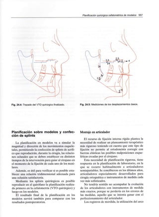 Planificación quirúrgica cefalométrica de modelos 557
Fig. 24.4: Trazado del VTO quirúrgicofinalizado. Fig. 24.5: Mediciones de los desplazamientos óseos.
Planificación sobre modelos y confec-
ción de splints
La planificación en modelos va a simular la
magnitud y dirección de los movimientos esquele-
tales, permitiendo la confección de splints de acríli-
co que reproducirán, durante la cirugía, las relacio-
nes oclusales que se deben establecer en distintos
tiempos de la intervención para guiar al cirujano en
el momento de la fijación de cada uno de los maxi-
lares.
Además, es útil para verificar si es posible esta-
blecer una relación tridimensional adecuada para
una oclusión satisfactoria.
Mediante los splints quirúrgicos es posible
reproducir en el quirófano la planificación realiza-
da primero en la cefalometría (VTO quirúrgico) y
luego en los modelos.
El resultado final de la planificación en los
modelos servirá también para comparar con los
resultados postoperatorios.
Montaje en articulador
El recurso de fijación interna rígida plantea la
necesidad de realizar un planeamiento terapéutico
más riguroso teniendo en cuenta que este tipo de
fijación no permite al ortodoncista corregir con
fuerzas elásticas las posibles malposiciones esque-
léticas creadas por el cirujano.
Esta necesidad de planificación rigurosa, tiene
respuesta en la planificación de laboratorio, en la
que se recurre habitualmente a articuladores
semiajustables. Se concibieron en los últimos años,
articuladores especialmente desarrollados para
cirugía ortognática e instrumentos de medida cada
vez más sofisticados.
No tendría sentido no acompañar la evolución
de los articuladores con instrumentos de medida
más exactos, porque se perdería en los errores de
las medidas, aquello que se intenta ganar con el
perfeccionamiento del articulador.
Los registros de mordida, la utilización del arco
 