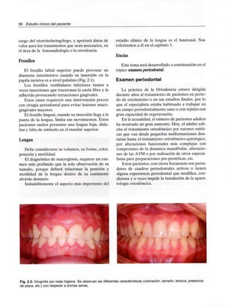 58 Estudio clínico del paciente
cargo del otorrinolaringólogo, y aportará datos de
valor para los tratamientos que sean necesarios, en
el área de la fonoaudiología o la ortodoncia.
Frenillos
El frenillo labial superior puede provocar un
diastema interincisivo cuando su inserción en la
papila incisiva es a nivel palatino (Fig. 2.1).
Los frenillos vestibulares inferiores tienen a
veces inserciones que traccionan la encía libre y la
adherida provocando retraccionesgingivales.
Estos casos requieren una intervención precoz
con cirugía periodontal para evitar lesiones muco-
gingivales mayores.
El frenillo lingual, cuando su inserción llega a la
punta de la lengua, limita sus movimientos. Estos
pacientes suelen presentar una lengua baja, disla-
lias y falta de estímulo en el maxilar superior.
Lengua
Debe considerarse su volumen, su forma, color,
posición y motilidad.
El diagnóstico de macroglosia, requiere un exa-
men más profundo que la sola observación de su
tamaño, porque deberá relacionar la posición y
motilidad de la lengua dentro de su continente
alvéolo dentario.
Indudablemente el aspecto más importante del
estudio clínico de la lengua es el funcional. Nos
referiremos a él en el capítulo 3.
Encías
Este tema será desarrollado a continuación en el
tópico examen periodontal.
Examen periodontal
La práctica de la Ortodoncia estuvo dirigida
durante años al tratamiento de pacientes en perío-
do de crecimiento o en sus estadios finales, por lo
que el especialista estaba habituado a trabajar en
un campo periodontalmente sano o con tejidos con
gran capacidad de regeneración.
En la actualidad, el número de pacientes adultos
ha mostrado un gran aumento. Hoy, el adulto soli-
cita el tratamiento ortodóncico por razones estéti-
cas que van desde pequeñas malformacionesden-
tarias hasta el tratamiento ortodóncico-quirúrgico,
por alteraciones funcionales más complejas con
compromiso de la dinámica mandibular,alteracio-
nes de las ATM o por indicación de otros especia-
listas para preparaciones pre-protéticas, etc.
Estos pacientes, con cierta frecuencia son porta-
dores de cuadros periodontales activos o tienen
alguna experiencia periodontal que modifica, con-
diciona y a veces impide la instalación de la apara-
tología ortodóncica.
Fig. 2.2: Gingivitis por mala higiene. Se observan las diferentes características (coloración, tamaño, textura,presencia
de placa, etc.) con respecto a encías sanas.
 