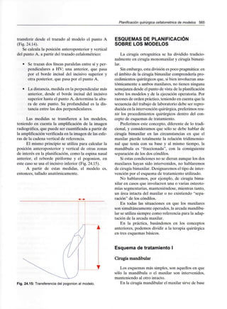 Planificación quirúrgica cefalométrica de modelos 565
transferir desde el trazado al modelo el punto A
(Fig. 24.14).
Se calcula la posición anteroposterior y vertical
del punto A, a partir del trazado cefalométrico:
• Se trazan dos líneas paralelas entre sí y per-
pendiculares a HV; una anterior, que pasa
por el borde incisal del incisivo superior y
otra posterior, que pasa por el punto A.
• La distancia, medida en la perpendicular más
anterior, desde el borde incisal del incisivo
superior hasta el punto A, determina la altu-
ra de este punto. Su profundidad es la dis-
tancia entre las dos perpendiculares.
Las medidas se transfieren a los modelos,
teniendo en cuenta la amplificación de la imagen
radiográfica, que puede ser cuantificada a partir de
la amplificaciónverificada en la imagen de las esfe-
ras de la cadena vertical de referencia.
El mismo principio se utiliza para calcular la
posición anteroposterior y vertical de otras zonas
de interés en la planificación, como la espina nasal
anterior, el reborde piriforme y el pogonion, en
este caso se usa el incisivo inferior (Fig. 24.15).
A partir de estas medidas, el modelo es,
entonces, tallado anatómicamente.
Fig. 24.15: Transferencia del pogonion al modelo.
ESQUEMAS DE PLANIFICACIÓN
SOBRE LOS MODELOS
La cirugía ortognática se ha dividido tradicio-
nalmente en cirugía monomaxilar y cirugía bimaxi-
lar.
Sin embargo, esta división es poco pragmática: en
el ámbito de la cirugía bimaxilar comprendería pro-
cedimientos quirúrgicos que, si bien involucran ana-
tómicamente a ambos maxilares, no tienen ninguna
semejanza desde el punto de vista de laplanificación
sobre los modelos y de la ejecución operatoria. Por
razones de orden práctico, teniendo en cuenta que la
secuencia del trabajo de laboratorio debe ser repro-
ducida en la intervención quirúrgica,preferimos reu-
nir los procedimientos quirúrgicos dentro del con-
cepto de esquemas de tratamiento.
Preferimos este concepto, diferente de lo tradi-
cional, y consideramos que sólo se debe hablar de
cirugía bimaxilar en las circunstancias en que el
maxilar pierde totalmente la relación tridimensio-
nal que tenía con su base y al mismo tiempo, la
mandíbula es "fraccionada", con la consiguiente
separación de los dos cóndilos.
Si estas condiciones no se dieran aunque los dos
maxilares hayan sido intervenidos, no hablaremos
de cirugía bimaxilar. Designaremos el tipo de inter-
vención por el esquema de tratamiento utilizado.
No hablaremos, por ejemplo, de cirugía bima-
xilar en casos que involucren una o varias osteoto-
mías segmentarias, manteniéndose, mientras tanto,
un área intacta del maxilar o no existiendo "sepa-
ración" de los cóndilos.
En todas las situaciones en que los maxilares
son simultáneamente operados, la arcada mandibu-
lar se utiliza siempre como referencia para la adap-
tación de la arcada maxilar.
En la práctica, basándonos en los conceptos
anteriores, podemos dividir a la terapia quirúrgica
en tres esquemas básicos.
Esquema de tratamiento I
Cirugíamandibular
Los esquemas más simples, son aquellos en que
sólo la mandíbula o el maxilar son intervenidos,
manteniendo al otro intacto.
En la cirugía mandibular el maxilar sirve de base
 