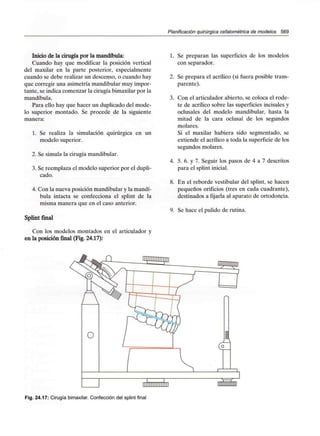 Planificación quirúrgica cefalométrica de modelos 569
Inicio de la cirugía por la mandíbula:
Cuando hay que modificar la posición vertical
del maxilar en la parte posterior, especialmente
cuando se debe realizar un descenso, o cuando hay
que corregir una asimetría mandibular muy impor-
tante, se indica comenzar la cirugía bimaxilar por la
mandíbula.
Para ello hay que hacer un duplicado del mode-
lo superior montado. Se procede de la siguiente
manera:
1. Se realiza la simulación quirúrgica en un
modelo superior.
2. Se simula la cirugía mandibular.
3. Se reemplaza el modelo superior por el dupli-
cado.
4. Con la nueva posición mandibular y la mandí-
bula intacta se confecciona el spiint de la
misma manera que en el caso anterior.
Spiint final
Con los modelos montados en el articulador y
en la posición final (Fig. 24.17):
1. Se preparan las superficies de los modelos
con separador.
2. Se prepara el acrílico (si fuera posible trans-
parente).
3. Con el articulador abierto, se coloca el rode-
te de acrílico sobre las superficies incisales y
oclusales del modelo mandibular, hasta la
mitad de la cara oclusal de los segundos
molares.
Si el maxilar hubiera sido segmentado, se
extiende el acrílico a toda la superficie de los
segundos molares.
4. 5. 6. y 7. Seguir los pasos de 4 a 7 descritos
para el spiint inicial.
8. En el reborde vestibular del spiint, se hacen
pequeños orificios (tres en cada cuadrante),
destinados a fijarla al aparato de ortodoncia.
9. Se hace el pulido de rutina.
Fig. 24.17: Cirugía bimaxilar. Confección del spiint final
 