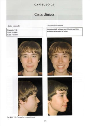 Datos personales
C A P I T U L O 25
Casos clínicos
Motivo de la consulta
Paciente: V.B.
Edad: 22 años.
Sexo:Femenino.
Sintomatologia articular y cefaleas frecuentes,
asociadas a períodos de stress.
Fig. 25.1: V. B. Fotografías iniciales de cara.
575
 