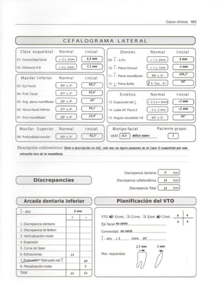 Casos clínicos 583
C E F A L O G R A M A L A T E R A L
Clase esqueletal Normal Inicial
01-Convexidad facial [ +2± 2mmJ [ 6,8 mm
02- Distancia A-B + 4± 2mm ] [ 7,1 mm ]
Maxilar Inferior Normal Inicial
03-Eje Facial ( 90°± 3° ] [ 88>2° }
04- Prof. Facial [ 87°± 3° J [ 85,6" J
05- Ang. plano mandibular ( 26°± 4° J [ 30° J
06-Altura facial inferior [ 47° ± 4° J [ ^J° J
07-Arco mandibular [ 26° ± 4° J [ 23>9° }
Normal I nicial
± 2mm 8mm
Dientes
09- 1 - A-Po ,
10-1 - Plano Oclusal 1 + 1 ± Imm . ,
11-1-Plano mandibular [ 90° ± 5° ] [ 1W'Z°
12-1-Plano BaNa (// E. Fac.-5°
-3 mm
93°
Estética Normal I nicial
13-Exposición del 1 [+2.5a+3mm] ( +3 mm ]
14- Labio inf.Plano E [ - 2 ± 2 mm~) [ *2 mm ~)
15- Ángulo nasolabial Inf. [ 85° ±5° ] | 83°
Maxilar Superior Normal
08-Profundidad maxilar [ 90°± 3°
I nicial
92,5" ]
Biotipo facial
VERTÍ-0,5 
Paciente grupo:
OD
Descripción cefalométrica: ídem a descripción en MIC, sólo hay un ligero aumento de la Clase II esqueletalpor una
retrusión leve de la mandíbula.
Discrepancias
Arcada dentaria inferior X Planificación del VTO
/•
1-APo
1. Discrepancia dentaria
2. Discrepancia de Bolton
3. Verticalización molar
4. Expansión
5. Curva de Spee
6. Extracciones
TJíEQtEtíetérr7 Retrusión del 1
8. Mesializadón molar
Total
V
N
8 mm
+
15
15
-
10
5
15
J
Discrepancia dentaria [ O mm]
Discrepancia cefalométrica [ 14 mm]
Discrepancia Total ( in mm]
VTO: 9É> S/crec. O C/crec. O S/ext. <<) C/ext.
Eje facial "ovaría.
Convexidad .."ovaría
I-APo...íJ IMPA ..#?!
2,5 mm 5 mm
Mov. requeridos:
 