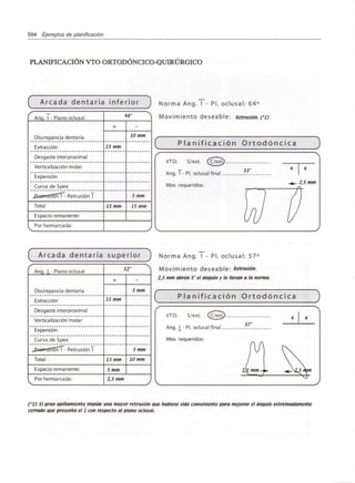 594 Ejemplos de planificación
PLANIFICACIÓN VTO ORTODÓNCICO-QUIRÚRGICO
í A r c a d a dentaria
Anq. 1 - Plano oclusal
Discrepancia dentaria
Extracción
Desgaste interproximal
Verticalización molar
Expansión
Curva de Spee
J2j«trasl5"ñ~T"- Retrusión T
Total
Espacio remanente:
Por hemiarcada:
infei
{
+
15 mm
15 mm
'ior J
•R" '
-
10 mm
5 mm
15 mm
J
Norma Ang. 1 - Pl. oclusal: 64°
Movimiento deseable: Retrusión. (*l)
I P l a n i f i c a c i ó n O r t o d ó n c i c a J
/" N
VTO- S/ext (C/ext)
53° * *
Ang. 1 - Pl. oclusal final
Mov. requeridos: "*~/>'5 """
( 1 /)
In
(W u
^s _/ Ls
^ J
A r c a d a dentaria superior J Norma Ang.1 - Pl. oclusal: 57°
s~
Ang. 1- Plano oclusal
Discrepancia dentaria
Extracción
Desgaste interproximal
Verticalización molar
Expansión
Curva de Spee
JipetraSTÓñT- Retrusión T
Total
Espacio remanente:
Por hemiarcada:
5
+
15 mm
15 mm
5 mm
2,5 mm
r A
-
5 mm
5 mm
10 mm
J
Movimiento deseable:
2,5 mm abren 5° el ángulo y lo llevan a la norma.
P l a n i f i c a c i ó n O r t o d ó n c i c a
VTO: S/ext. (C/ext;
Ang. 1_- Pl. oclusal final ..
Mov. requeridos:
57°
2}5 mm - »-
C*l): Elgran apiñamientqjmpide una mayor retrusión que hubiese sido conveniente para mejorar el ángulo extremadamente
cerrado que presenta el 1 con respecto al plano oclusal.
 