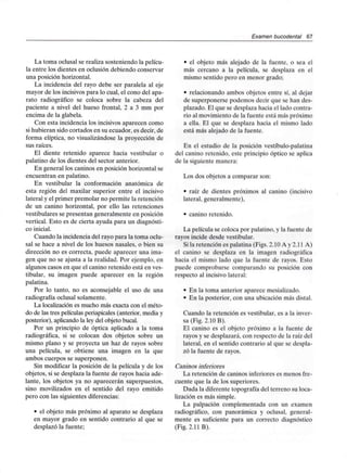 Examen bucodental 67
La toma oclusal se realiza sosteniendo la pelícu-
la entre los dientes en oclusión debiendo conservar
una posición horizontal.
La incidencia del rayo debe ser paralela al eje
mayor de los incisivos para lo cual, el cono del apa-
rato radiográfico se coloca sobre la cabeza del
paciente a nivel del hueso frontal, 2 a 3 mm por
encima de la glabela.
Con esta incidencia los incisivos aparecen como
si hubieran sido cortados en su ecuador, es decir, de
forma elíptica, no visualizándose la proyección de
sus raíces.
El diente retenido aparece hacia vestibular o
palatino de los dientes del sector anterior.
En general los caninos en posición horizontal se
encuentran en palatino.
En vestibular la conformación anatómica de
esta región del maxilar superior entre el incisivo
lateral y el primer premolar no permite la retención
de un canino horizontal, por ello las retenciones
vestibulares se presentan generalmente en posición
vertical. Esto es de cierta ayuda para un diagnósti-
co inicial.
Cuando la incidencia del rayo para la toma oclu-
sal se hace a nivel de los huesos nasales, o bien su
dirección no es correcta, puede aparecer una ima-
gen que no se ajusta a la realidad. Por ejemplo, en
algunos casos en que el canino retenido está en ves-
tibular, su imagen puede aparecer en la región
palatina.
Por lo tanto, no es aconsejable el uso de una
radiografía oclusal solamente.
La localización es mucho más exacta con el méto-
do de las tres películas periapicales (anterior, media y
posterior), aplicando la ley del objeto bucal.
Por un principio de óptica aplicado a la toma
radiográfica, si se colocan dos objetos sobre un
mismo plano y se proyecta un haz de rayos sobre
una película, se obtiene una imagen en la que
ambos cuerpos se superponen.
Sin modificar la posición de la película y de los
objetos, si se desplaza la fuente de rayos hacia ade-
lante, los objetos ya no aparecerán superpuestos,
sino movilizados en el sentido del rayo emitido
pero con las siguientes diferencias:
• el objeto más próximo al aparato se desplaza
en mayor grado en sentido contrario al que se
desplazó la fuente;
• el objeto más alejado de la fuente, o sea el
más cercano a la película, se desplaza en el
mismo sentido pero en menor grado;
• relacionando ambos objetos entre sí, al dejar
de superponerse podemos decir que se han des-
plazado. El que se desplaza hacia el lado contra-
rio al movimiento de la fuente está más próximo
a ella. El que se desplaza hacia el mismo lado
está más alejado de la fuente.
En el estudio de la posición vestíbulo-palatina
del canino retenido, este principio óptico se aplica
de la siguiente manera:
Los dos objetos a comparar son:
• raíz de dientes próximos al canino (incisivo
lateral, generalmente),
• canino retenido.
La película se coloca por palatino, y la fuente de
rayos incide desde vestibular.
Si la retención es palatina (Figs. 2.10 A y 2.11 A)
el canino se desplaza en la imagen radiográfica
hacia el mismo lado que la fuente de rayos. Esto
puede comprobarse comparando su posición con
respecto al incisivo lateral:
• En la toma anterior aparece mesializado.
• En la posterior, con una ubicación más distal.
Cuando la retención es vestibular, es a la inver-
sa (Fig. 2.10 B).
El canino es el objeto próximo a la fuente de
rayos y se desplazará, con respecto de la raíz del
lateral, en el sentido contrario al que se despla-
zó la fuente de rayos.
Caninos inferiores
La retención de caninos inferiores es menos fre-
cuente que la de los superiores.
Dada la diferente topografía del terreno su loca-
lización es más simple.
La palpación complementada con un examen
radiográfico, con panorámica y oclusal, general-
mente es suficiente para un correcto diagnóstico
(Fig. 2.11 B).
 