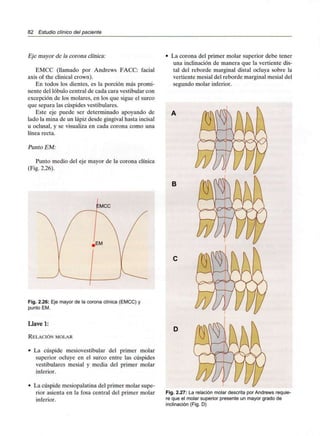82 Estudio clínico del paciente
Eje mayor de ¡a corona clínica:
EMCC (llamado por Andrews FACC: facial
axis of the clinical crown).
En todos los dientes, es la porción más promi-
nente del lóbulo central de cada cara vestibular con
excepción de los molares, en los que sigue el surco
que separa las cúspides vestibulares.
Este eje puede ser determinado apoyando de
lado la mina de un lápiz desde gingivalhasta incisal
u oclusal, y se visualiza en cada corona como una
línea recta.
Punto EM:
Punto medio del eje mayor de la corona clínica
(Fig. 2.26).
Fig. 2.26: Eje mayor de la corona clínica (EMCC) y
punto EM.
Llave 1:
RELACIÓN MOLAR
• La cúspide mesiovestibular del primer molar
superior ocluye en el surco entre las cúspides
vestibulares mesial y media del primer molar
inferior.
• La cúspide mesiopalatina del primer molar supe-
rior asienta en la fosa central del primer molar
inferior.
La corona del primer molar superior debe tener
una inclinación de manera que la vertiente dis-
tal del reborde marginal distal ocluya sobre la
vertiente mesial del reborde marginal mesial del
segundo molar inferior.
B
Fig. 2.27: La relación molar descrita por Andrews requie-
re que el molar superior presente un mayor grado de
inclinación (Fig. D)
 