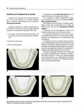 88 Estudio clínico del paciente
Análisis de la longitud de la arcada
Análisis de la relación entre el espacio disponi-
ble en la arcada dentaría y el espacio requerido
para el correcto posicionamiento de los dientes.
Discrepancia dentaria.
Cuando realizamos un análisis intramaxilar de
la posición de los dientes en sus arcadas podemos
encontrar tres situaciones diferentes (Fig. 2.38).
1. Los dientes están perfectamente alineados, con
sus puntos de contacto correctamente estableci-
dos.
2. Se observan diastemas.
3. Existen apiñamientos.
En el primer caso no existe discrepancia entre el
material dentario y la longitud de la arcada.
En el segundo, el espacio disponible es mayor
que el requerido, por lo que se denomina discre-
pancia dentaria positiva.
En el último, por el contrario, el espacio reque-
rido es mayor que el disponible en la arcada. Se
habla en este caso de una discrepancia dentaria
negativa.
El estudio de esta discrepancia se hace en la
dentición permanente o en la dentición mixta.
Es necesario cuantificarla con la mayor exacti-
tud posible debido a que es uno de los datos funda-
mentales que utilizaremos en la planificación del
tratamiento.
La longitud real de la arcada (espacio disponi-
ble), es la longitud de una línea que va desde la cara
mesial de un primer molar permanente a la cara
mesial de su homólogo del lado opuesto, pasando a
través de los puntos de contacto de premolares y
caninos y los bordes incisales de los incisivos.
El espacio requerido está dado por la suma de
los anchos mesiodistales de los dientes mesiales a
los primeros molares. Como estos dientes pueden
estar erupcionados o no, distinguiremos métodos
diferentes para el análisis de la dentición perma-
nente y de la dentición mixta.
Fig. 2.38: Discrepancia dentaria. A: Arcada sin discrepancia. B: Arcada con discrepancia negativa (apiñamientos). C:
Arcada con discrepancia positiva (diastemas)
 