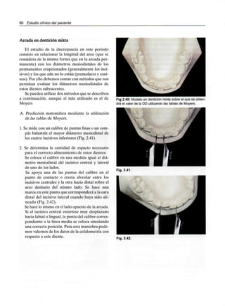 90 Estudio clínico del paciente
Arcada en dentición mixta
El estudio de la discrepancia en este período
consiste en relacionar la longitud del arco (que se
considera de la misma forma que en la arcada per-
manente) con los diámetros mesiodistales de los
permanentes erupcionados (generalmente los inci-
sivos) y los que aún no lo están (premolares y cani-
nos). Por ello debemos contar con métodos que nos
permitan evaluar los diámetros mesiodistales de
estos dientes subyacentes.
Se pueden utilizar dos métodos que se describen
a continuación, aunque el más utilizado es el de
Moyers
A. Predicción matemática mediante la utilización
de ¡as tablas de Moyers.
1. Se mide con un calibre de puntas finas o un com-
pás balustrín el mayor diámetro mesiodistal de
los cuatro incisivosinferiores (Fig. 2.41).
2. Se determina la cantidad de espacio necesario
para el correcto alineamiento de estos dientes:
Se coloca el calibre en una medida igual al diá-
metro mesiodistal del incisivo central y lateral
de uno de los lados.
Se apoya una de las puntas del calibre en el
punto de contacto o cresta alveolar entre los
incisivos centrales y la otra hacia distal sobre el
arco dentario del mismo lado. Se hace una
marca en este punto que corresponderá a la cara
distal del incisivo lateral cuando haya sido ali-
neado (Fig. 2.42).
Se hace lo mismo en el lado opuesto de la arcada.
Si el incisivo central estuviese muy desplazado
hacia labial o lingual,la punta del calibre corres-
pondiente a la línea media se coloca simulando
una correcta posición. Para esta maniobra pode-
mos valemos de los datos de la cefalometría con
respecto a este diente.
Fig 2.40: Modelo en dentición mixta sobre el que se obten-
drá el valor de la DD utilizando las tablas de Moyers.
Fig. 2.41.
Fig. 2.42.
 