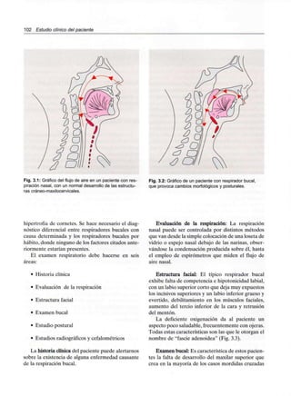 102 Estudio clínico del paciente
Fig. 3.1: Gráfico del flujo de aire en un paciente con res-
piración nasal, con un normal desarrollo de lasestructu-
rascráneo-maxilocervicales.
Fig. 3.2: Gráfico de un paciente con respirador bucal,
que provoca cambios morfológicos y posturales.
hipertrofia de cornetes. Se hace necesario el diag-
nóstico diferencial entre respiradores bucales con
causa determinada y los respiradores bucales por
hábito, donde ninguno de los factores citados ante-
riormente estarían presentes.
El examen respiratorio debe hacerse en seis
áreas:
• Historia clínica
• Evaluación de la respiración
• Estructura facial
• Examen bucal
• Estudio postural
• Estudios radiográficosy cefalométricos
La historia clínica del paciente puede alertarnos
sobre la existencia de alguna enfermedad causante
de la respiración bucal.
Evaluación de la respiración: La respiración
nasal puede ser controlada por distintos métodos
que van desde la simple colocación de una loseta de
vidrio o espejo nasal debajo de las narinas, obser-
vándose la condensación producida sobre él, hasta
el empleo de espirómetros que miden el flujo de
aire nasal.
Estructura facial: El típico respirador bucal
exhibe falta de competencia e hipotonicidad labial,
con un labio superior corto que deja muy expuestos
los incisivos superiores y un labio inferior grueso y
evertido, debilitamiento en los músculos faciales,
aumento del tercio inferior de la cara y retrusión
del mentón.
La deficiente oxigenación da al paciente un
aspecto poco saludable, frecuentemente con ojeras.
Todas estas características son las que le otorgan el
nombre de "fascie adenoidea" (Fig. 3.3).
Examen bucal: Es característica de estos pacien-
tes la falta de desarrollo del maxilar superior que
crea en la mayoría de los casos mordidas cruzadas
 
