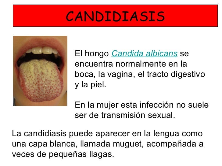 De que hay un hongo sobre las uñas en los pies de la foto