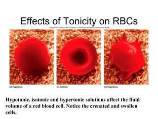 Effects of Tonicity on RBCs




Hypotonic, isotonic and hypertonic solutions affect the fluid
volume of a red blood cell. Notice the crenated and swollen
cells.
 