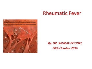 Rheumatic Fever
By:DR.SAURAVPOUDEL
20thOctober2016
 