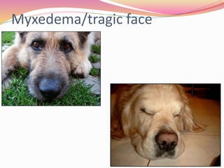 Myxedema/tragic face
 