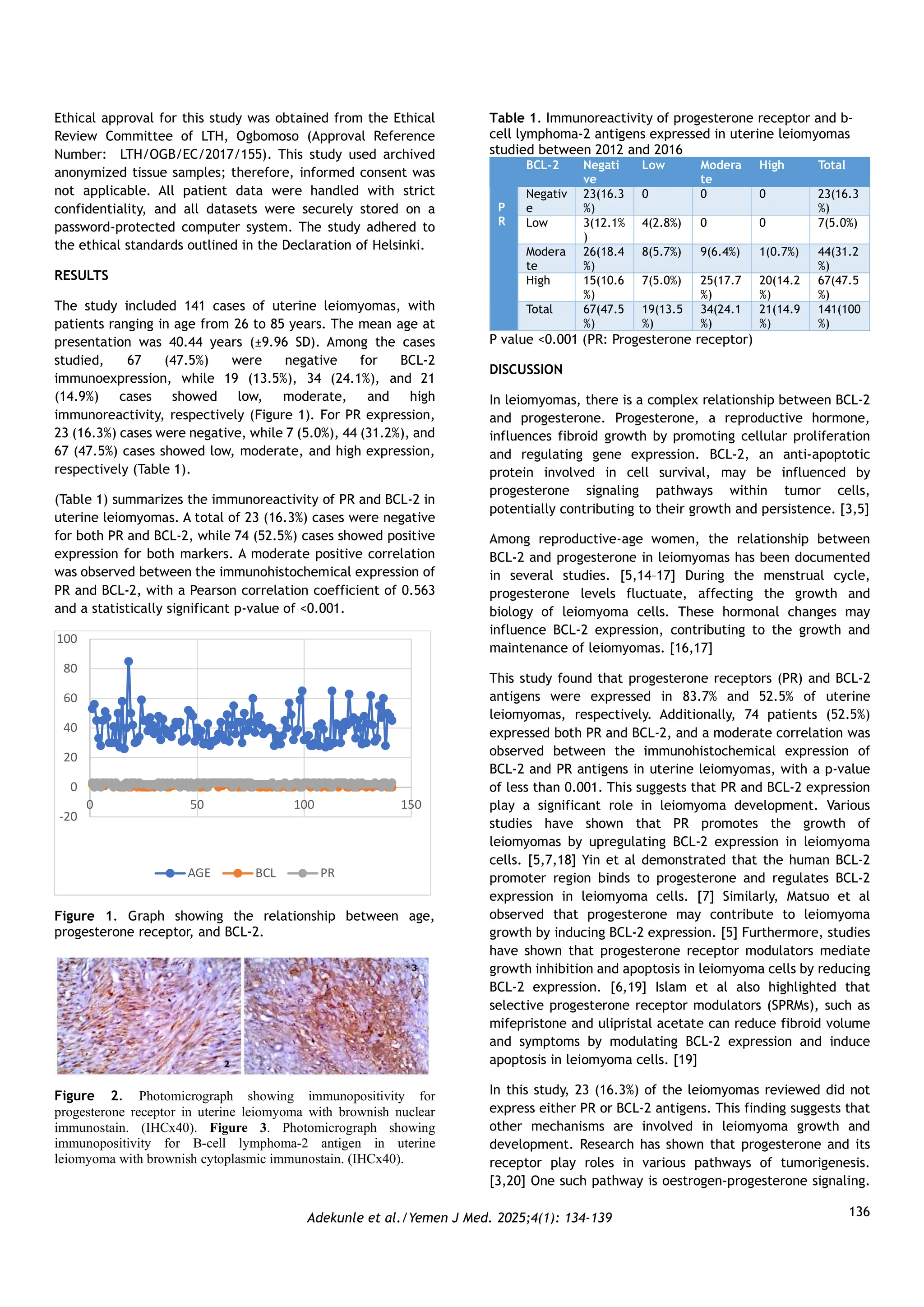 Immunohistochemical Expression of Progesterone Receptor and B-cell ...