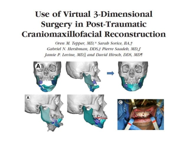 Viagra use before surgery