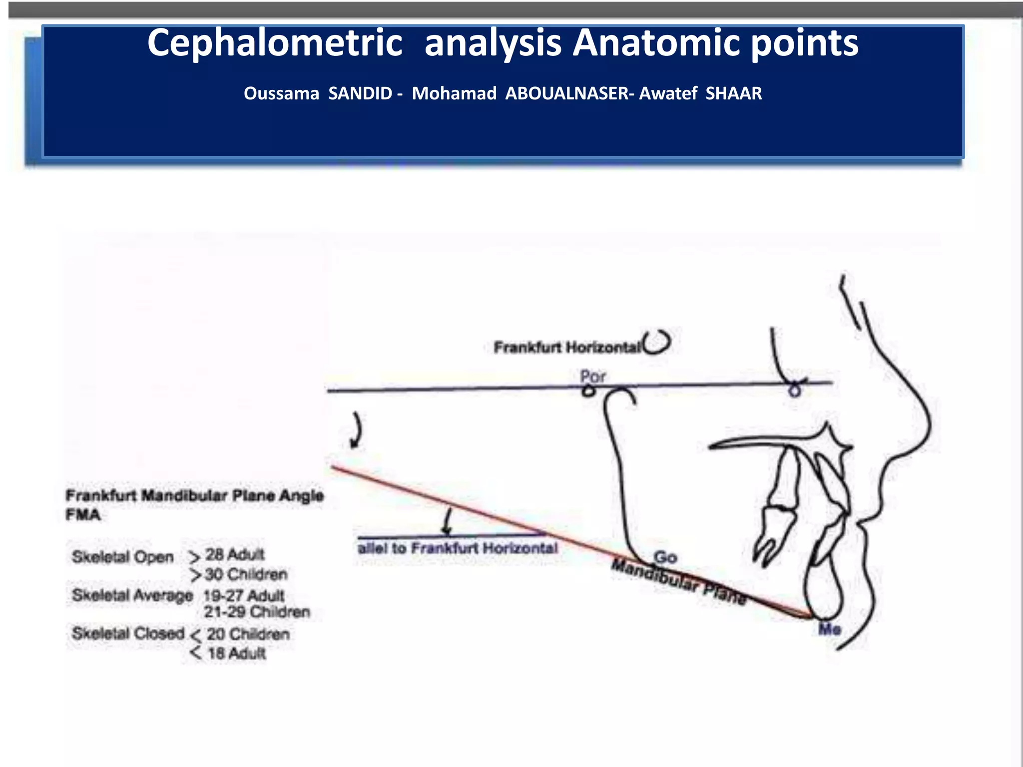 Cephalometric analysis Anatomic points
Oussama SANDID - Mohamad ABOUALNASER- Awatef SHAAR
 