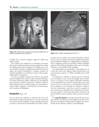 IGURA   Resonancia magnética coronal del abdomen en
la que se observan los riñones (*). IGURA   Imagen ecográfica del riñon (*).
variables de la toma de imágenes según los tejidos que
quiera resaltar.
Para realizar esta exploración se introduce al paciente
dentro de un tubo que genera campos magnéticos y ondas
de radiofrecuencia que se dirigen a los tejidos que se de-
sean estudiar. Aunque la exploración puede hacer sentir al
sujeto una intensa claustrofobia y requiere soportar un
ruido desagradable, no es dolorosa ni posee efectos perju-
diciales para el organismo.
Una de las grandes ventajas de la RM es que puede
obtener imágenes del cuerpo en todos los planos del espa-
cio (axial, transversal, sagital y oblicuos) sin necesidad de
que el paciente cambie su posición. También estudia el
árbol cardiovascular sin utilizar medios de contraste detec-
tando el flujo sanguíneo al discriminar los movimientos
de los núcleos de hidrógeno.
Ecografía (Fig. 1-9)
En esta técnica las imágenes se obtienen por el uso de
ultrasonidos (vibraciones mecánicas con una frecuencia
por encima del nivel audible). La parte elegida del cuerpo
se somete a una fuente de ultrasonidos, los cuales, al inter-
accionar con los tejidos, son en parte devueltos en forma
de ecos. Los ecos poseen patrones de amplitud específicos
para los diferentes tejidos y son digitalizados y transforma-
dos en imágenes móviles que permiten analizar múltiples
aspectos de los diferentes órganos, tales como el tamaño,
la forma y el contenido de las cavidades.
Los ultrasonidos son producidos y detectados por un
cristal que oscila muy deprisa (efecto piezoeléctrico) con
una frecuencia superior a 1 MHz, inaudible para el oído
humano.
La ecografía es indolora y puede repetirse todas las
veces necesarias ya que carece de peligro para la salud.
El aire y el hueso y otros tejidos calcificados absorben
casi la totalidad de las ondas de ultrasonidos, por lo que
esta técnica no es útil para ver el estado de los huesos o
de los pulmones. Sin embargo, los líquidos conducen
bien los ultrasonidos, razón por la que la ecografía es
una técnica muy empleada para el diagnóstico de quis-
tes, para explorar estructuras del aparato urinario o de
las vías biliares y para visualizar el feto en el saco amnió-
tico.
La ecografía doppler es un tipo especial de esta técnica
que analiza el movimiento de la sangre, por lo que se em-
plea para estudiar la vascularización de órganos o el movi-
miento de las válvulas cardíacas (ecocardiografía).
 3ECCIØN ) Introducción a la anatomía
 
