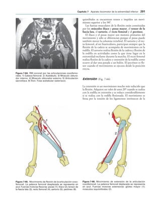 IGURA   RM coronal por las articulaciones coxofemo-
rales. 1) Cabeza femoral. 2) Acetábulo. 3) Músculo obtura-
dor interno. 4) Músculo obturador externo. 5) Articulación
sacroilíaca. 6) Ílion. Fosa acetabular (asterisco).
IGURA   Movimiento de flexión de la articulación coxo-
femoral. La palanca femoral desplazada se representa en
azul. Fuerzas motoras flexoras: psoas (1); ilíaco (2); tensor de
la fascia lata (3); recto femoral (4); sartorio (5); pectíneo (6).
IGURA   Movimiento de extensión de la articulación
coxofemoral. La palanca femoral deplazada se representa
en azul. Fuerzas motoras extensoras: glúteo mayor (1);
músculos isquiotibiales (2).
quiotibiales se encuentran tensos e impiden un movi-
miento superior a los 90°.
Las fuerzas musculares de la flexión están constituidas
por los músculos ilíaco y psoas mayor, el tensor de la
fascia lata, el sartorio, el recto femoral y el pectíneo.
El ilíaco y el psoas mayor son motores primarios del
movimiento y sólo se diferencian porque el psoas puede
también mover la columna vertebral. El sartorio y el rec-
to femoral, al ser biarticulares, participan siempre que la
flexión de la cadera se acompaña de movimientos en la
rodilla. El sartorio realiza flexión de la cadera y flexión de
la rodilla en actividades como la que tiene lugar en la
extremidad oscilante durante la marcha. El recto femoral
realiza flexión de la cadera y extensión de la rodilla como
ocurre al dar una patada a un balón. El pectíneo es fle-
xor cuando el movimiento se ejecuta desde la posición
erecta.
Extensión (Fig. 7-66)
La extensión es un movimiento mucho más reducido que
la flexión. Adquiere un valor de unos 20° cuando se realiza
con la rodilla en extensión y se reduce considerablemente
si se realiza con la rodilla flexionada. El movimiento se
frena por la tensión de los ligamentos intrínsecos de la
#APÓTULO  Aparato locomotor de la extremidad inferior 
 