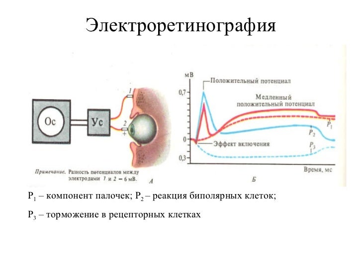 Вестибуло моторные реакции