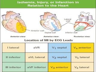 15504781-ISCHEMIA-LEZIUNEA-I-NECROZA-POWERPOINT.ppt