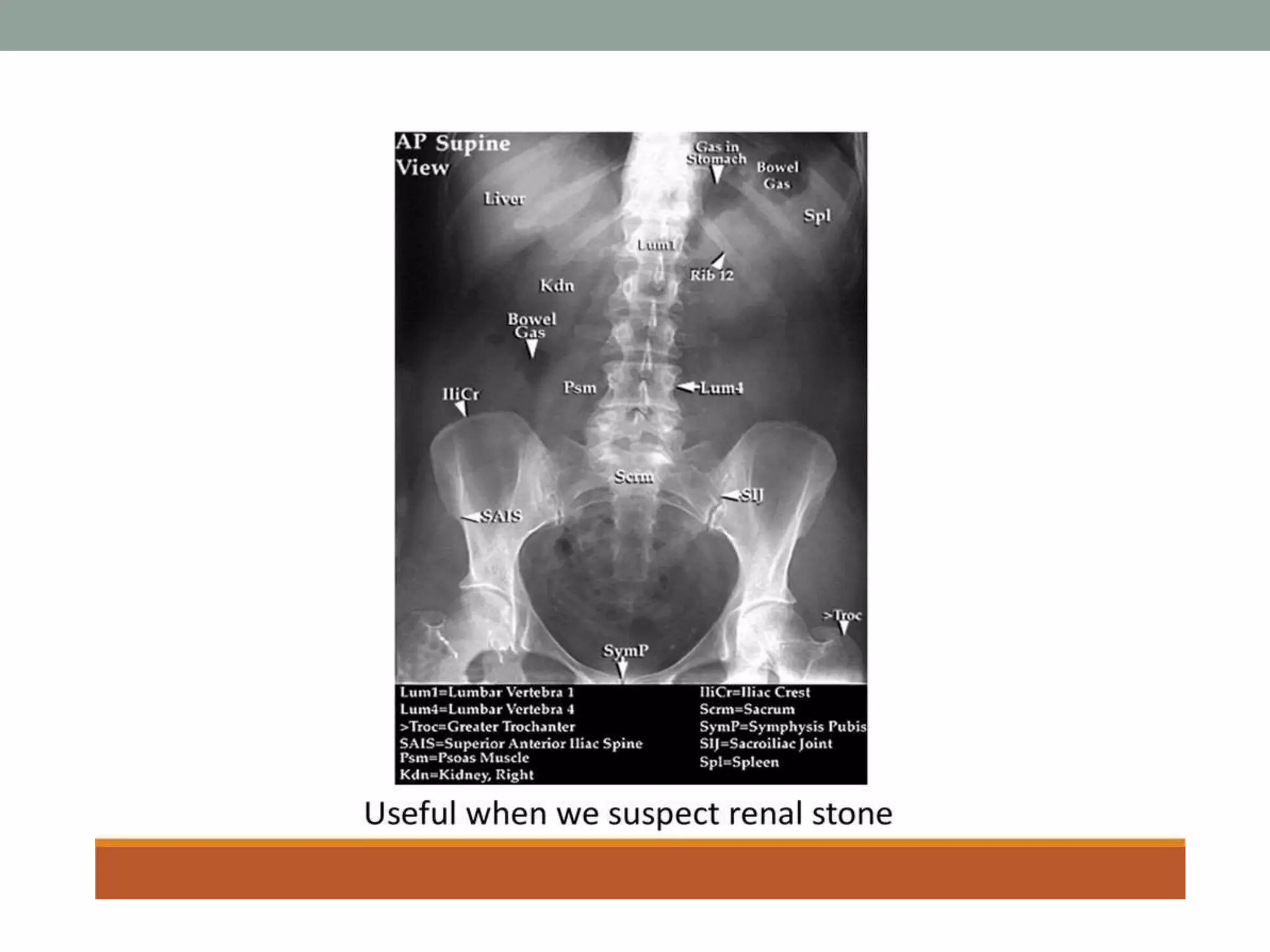Urography Examples CT urography | PPTX