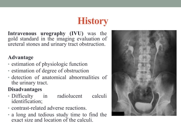 CT urography | PPTX | Digestive Disorders | Diseases and Conditions