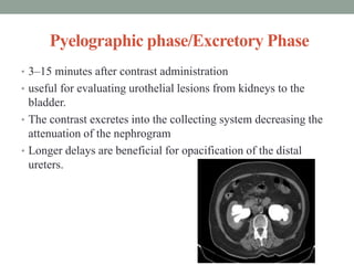 Retained Pyelogram Ct CT urography | PPTX