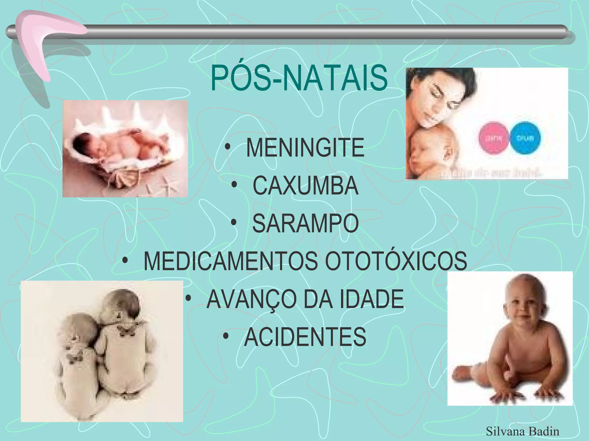 PÓS-NATAIS MENINGITE CAXUMBA SARAMPO MEDICAMENTOS OTOTÓXICOS AVANÇO DA IDADE ACIDENTES Silvana Badin 