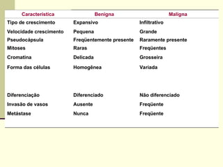 Característica Benigna Maligna
Tipo de crescimento Expansivo Infiltrativo
Velocidade crescimento Pequena Grande
Pseudocápsula Freqüentemente presente Raramente presente
Mitoses Raras Freqüentes
Cromatina Delicada Grosseira
Forma das células Homogênea Variada
Diferenciação Diferenciado Não diferenciado
Invasão de vasos Ausente Freqüente
Metástase Nunca Freqüente
 