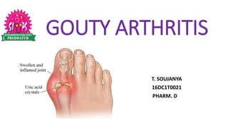 GOUTY ARTHRITIS
T. SOUJANYA
16DC1T0021
PHARM. D
 