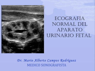 Dr. Mario Alberto Campos Rodríguez
MEDICO SONOGRAFISTA
Ecografía
Normal dEl
aparato
uriNario fEtal
 