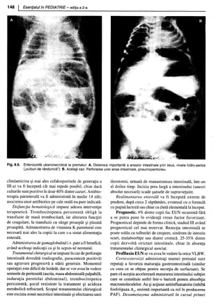 157414577-Esentialul-in-Pediatrie-Ciofu.pdf