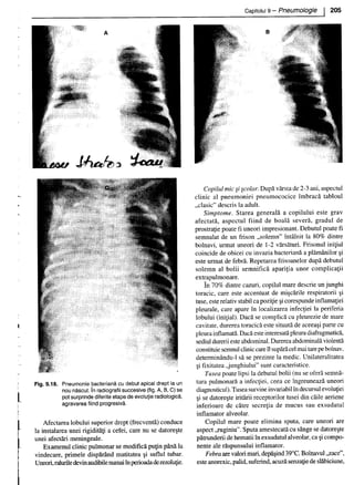 157414577-Esentialul-in-Pediatrie-Ciofu.pdf